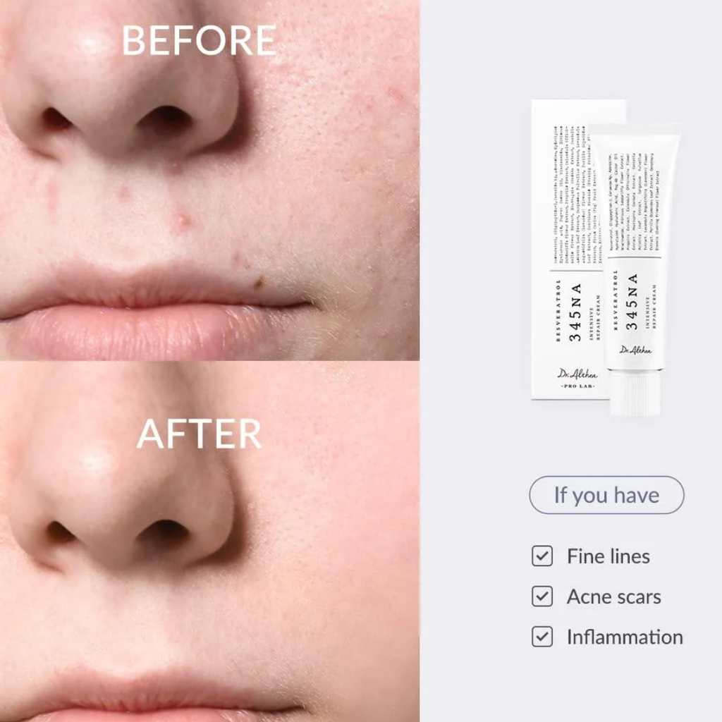 Dr. Althea 345 Relief Cream