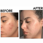 Dr. Althea 345 Relief Cream